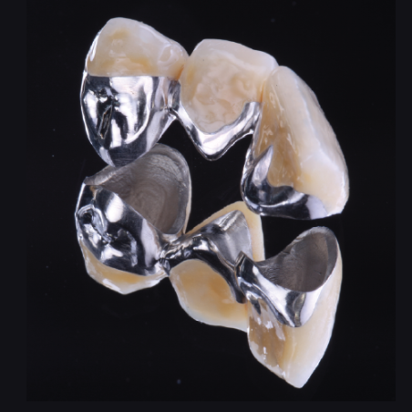 PFM Non-Precious Metal Crown