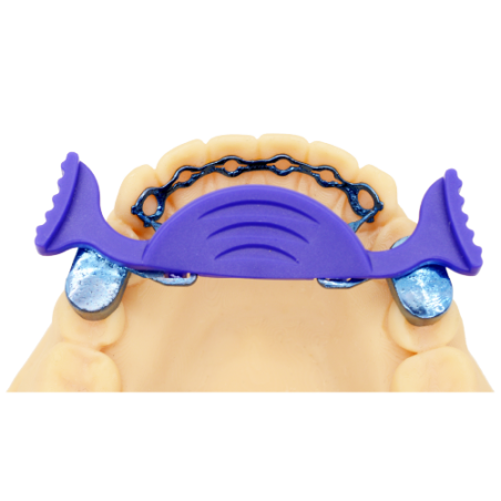 Infinity Fixed Lingual Retainer (Upper & Lower set) - Titanium