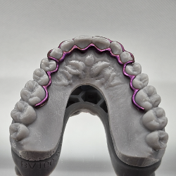 Atlas Mandibular and Maxillary Retainer Set - Titanium