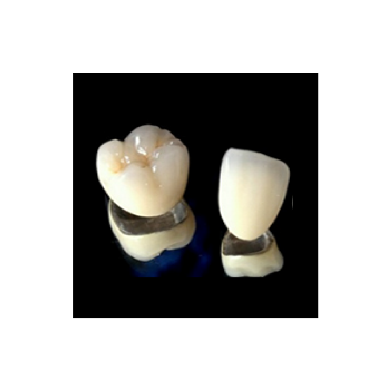 PFM Non-Precious Metal Crown