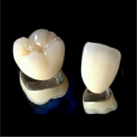 PFM Non-Precious Metal Crown