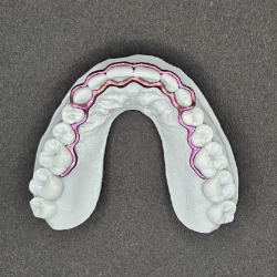 Atlas Maxillary Retainer