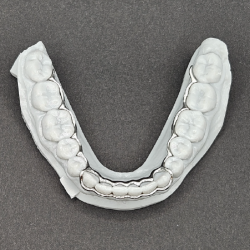 Atlas Mandibular Retainer (no lingual bar)